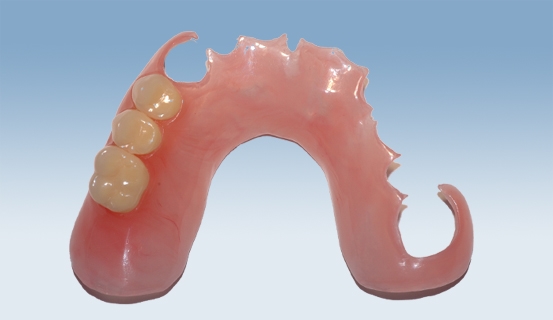 valplast 1