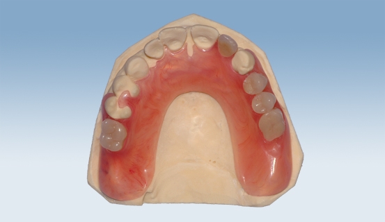 valplast 4