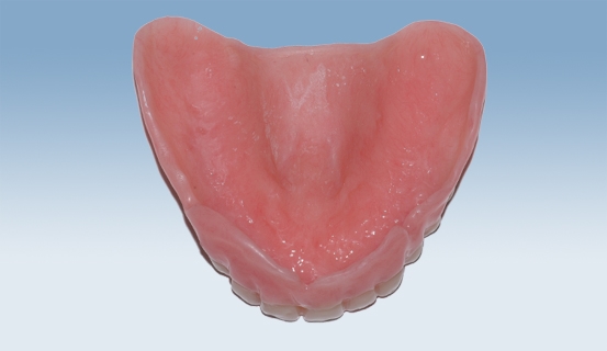 helprotese4